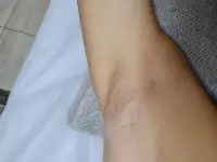 Шугаринг, фотография 5