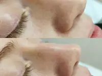 Приглашаю на первую БЕСПЛАТНУЮ косметологическую процедуру, фотография 3