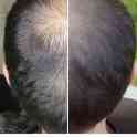 Трихопигментация головы в Алматы, фотография 5