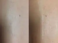 Шугаринг, фотография 4