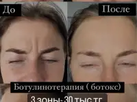 Курс Иньекционой косметологии!!!, фотография 2