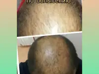 Косметолог -Массажист Тайский массаж, фотография 6