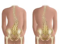 Лечебный массаж для позвоночника, фотография 2