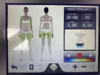 Продам итальянское Оборудование для аппаратного омоложения и Коррекции фигуры, фотография 2