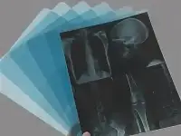 Скупка Рентген Плёнки | Астана - 2023, фотография 2