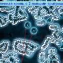 Новейшая диагностика крови, фотография 1