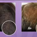 Спрей для восстановления и укрепления волос Shevelux