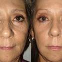 Крем против морщин Jeunesse Instantly Ageless , фотография 2
