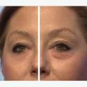Крем против морщин Jeunesse Instantly Ageless 