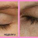 Средство для роста ресниц и бровей Lurey Lash Md, фотография 2