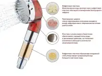 Ручной душ (лейка без шланга) - ионизатор воды, фотография 2