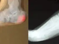 Лечение по традиционной китайской медицине, фотография 4