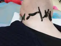 лечение пиявками профессионально недорого, фотография 2