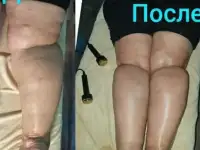 Косметолог -Массажист Тайский массаж, фотография 12