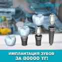Имплантация зубов в Астане с гарантией!, фотография 1