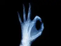 Рентген Плёнка - Утилизация Покупка Сдать Продать Куплю, фотография 3