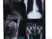 Рентген Плёнка - Утилизация Покупка Сдать Продать Куплю, фотография 2