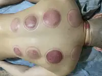 Массаж лечебный,оздоровительный, фотография 4