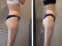 Антицеллюлитный массажКоррекция фигуры, фотография 2