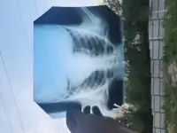 Скупка рентгеновских снимков в Таразе