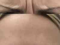 Косметолог Увеличение губ, фотография 11