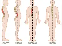 Лечебный массаж для позвоночника, фотография 3