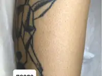 Шугаринг, фотография 4