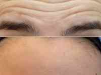Косметолог Увеличение губ, фотография 7