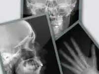 Рентген Плёнка - Утилизация Покупка Сдать Продать Куплю, фотография 5