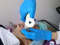 Капилляротерапия лица. Обращайтесь