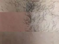 Шугаринг, фотография 3