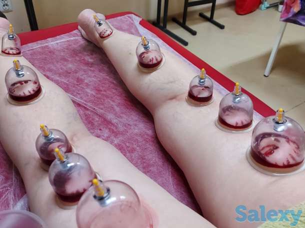 Хиджама, фотография 4