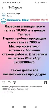 Лазерная эпиляция всего тела, фотография 1