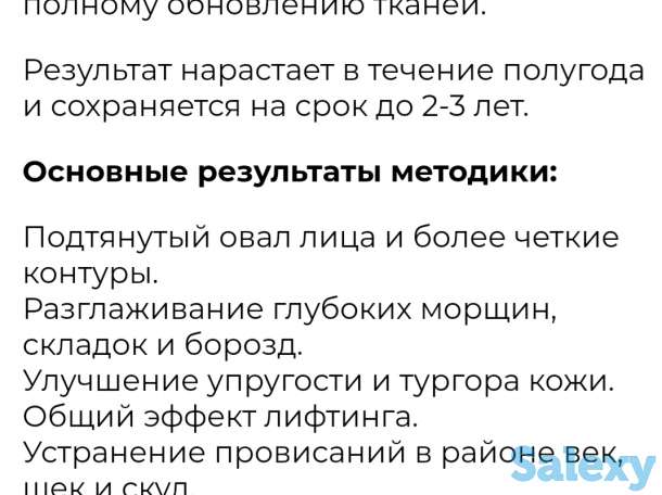 Рф-лифтинг, фотография 9