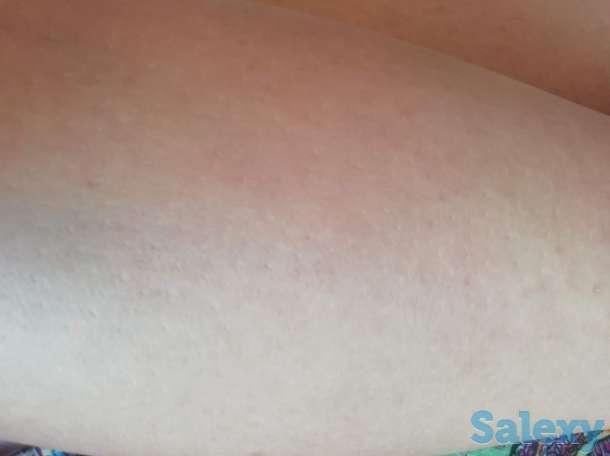 Шугаринг с выездом на дом., фотография 2