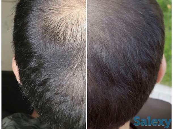 Трихопигментация головы в Алматы, фотография 5