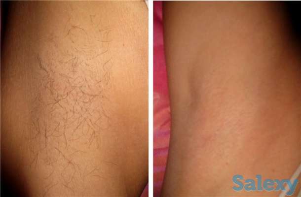 Шугаринг. Сахарная эпиляция. Персидская эпиляция., фотография 3