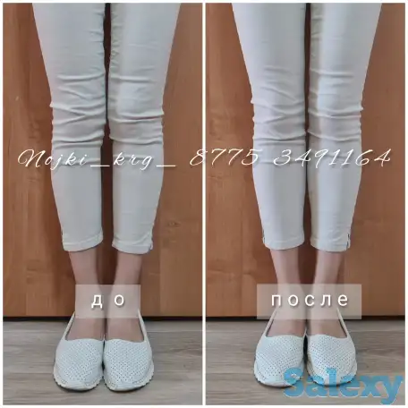 Силиконовые накладки для кривых ног, фотография 4