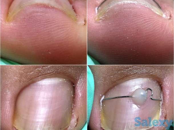 Ноги - наше всё, фотография 6