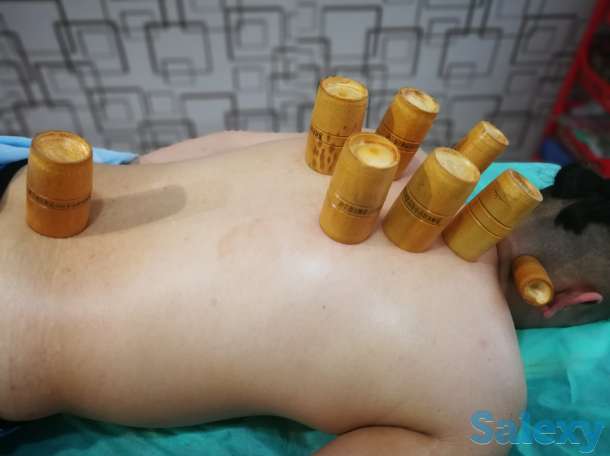 Иглотерапия, массаж, Хиджама, ЛФК, лечение огнём, баночный массаж, фотография 7