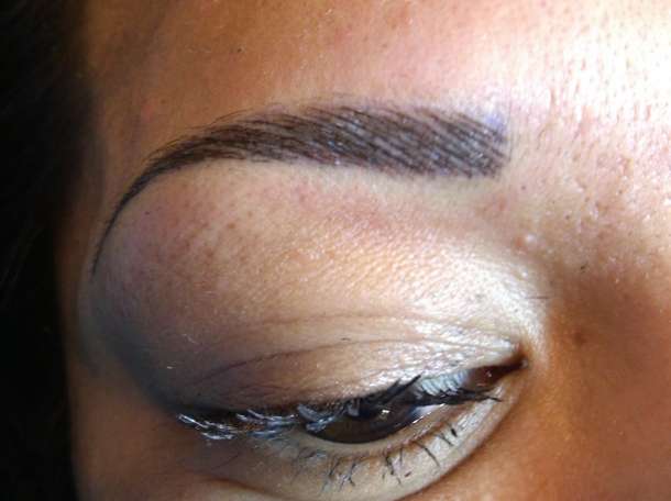 татуировки, татуаж, удаление, фотография 2