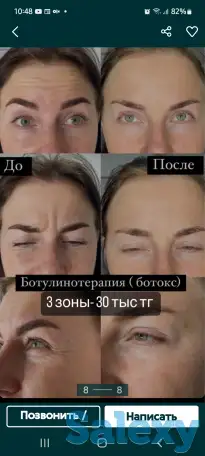 Курс Иньекционой косметологии!!!, фотография 2