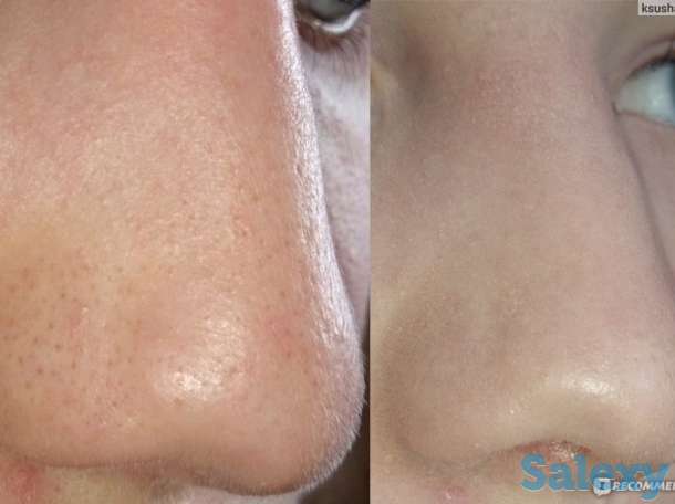 Инновация! BB glou! (тональный крем на год), фотография 4