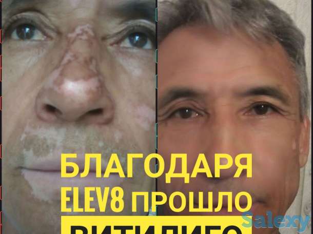 Здоровье и бизнес с продуктом правильного клеточного питания ELEV8 компании BEPIC, фотография 4