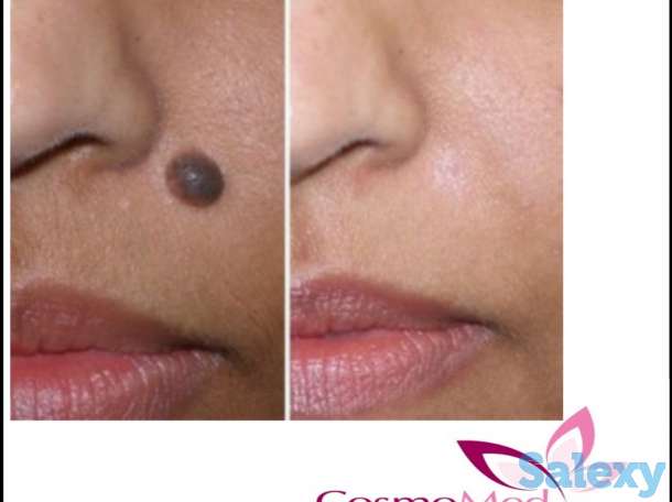 Открытие М/Ц Cosmomed, фотография 10