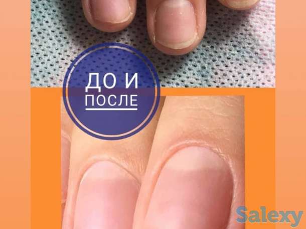 Услуги ногтевого сервиса маникюр с выравниванием и укреплением, педикюр, удаление врошего ногтя, дизайн, худ.роспись., фотография 5