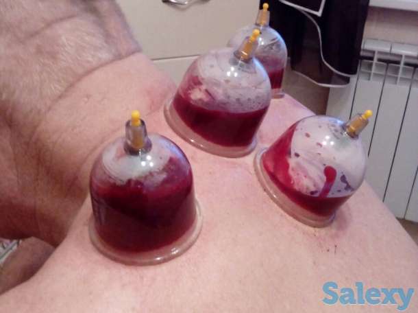 Хиджама, фотография 2