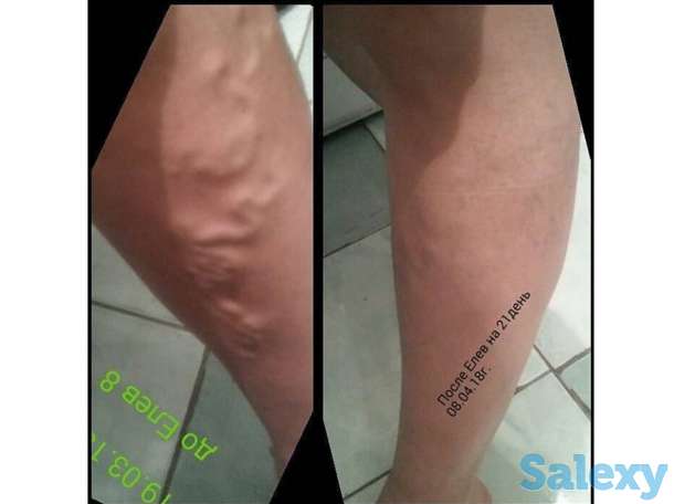 ELEV8 Уникальный продукт и бизнес для улучшения качества вашей жизни, фотография 11