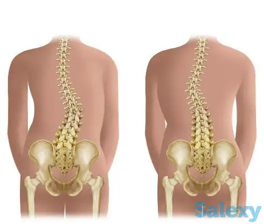 Лечебный массаж для позвоночника, фотография 2