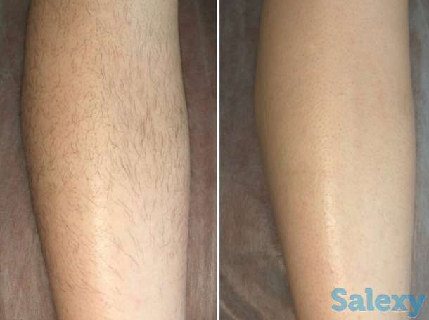 Шугаринг. Сахарная эпиляция. Персидская эпиляция., фотография 2